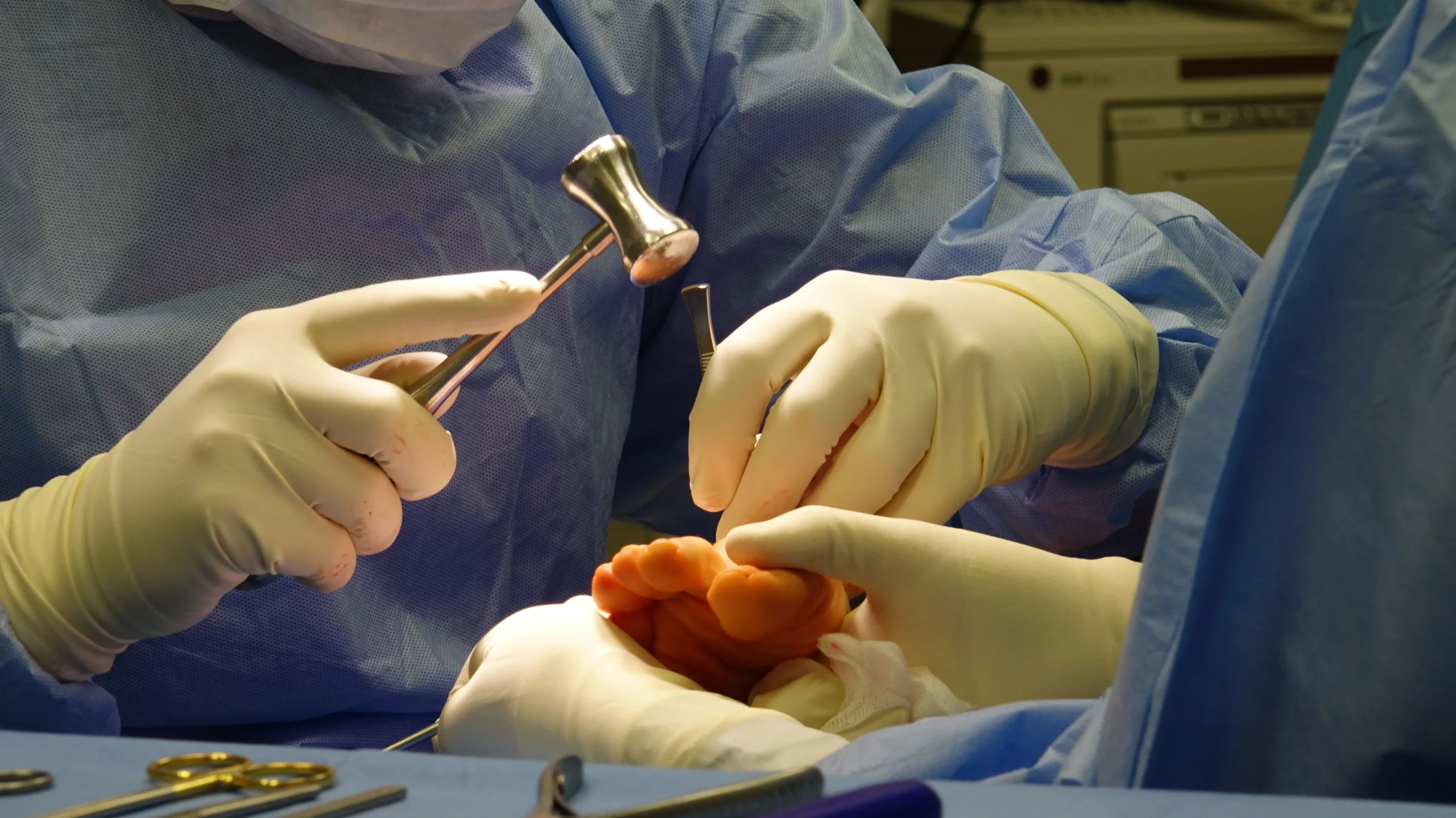 Minimally Invasive Surgery